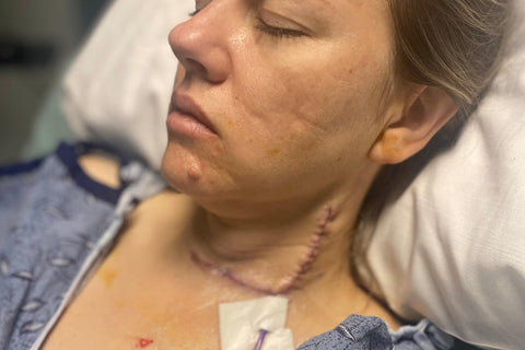 The-Cancer-Warrior-Christin-Hart