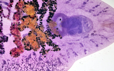 what-are-liver-flukes