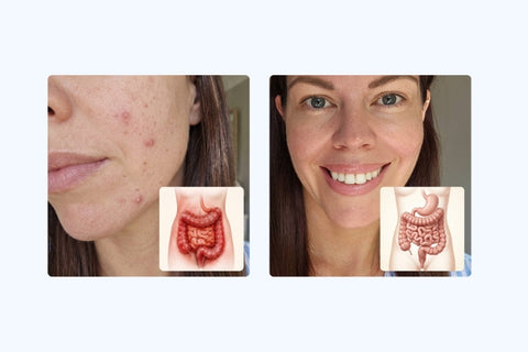 gut-skin-connection