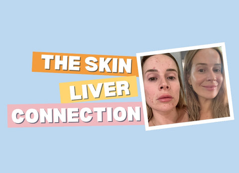 skin-liver-connection