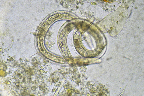 The Sneaky Things Parasites Do Inside the Human Body